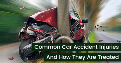 Five Common Car Accident Injuries And How They Are Treated ...