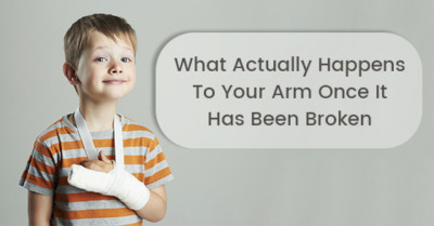 What Actually Happens To Your Arm Once It Has Been Broken ...