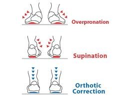 Custom Orthotics Bramalea